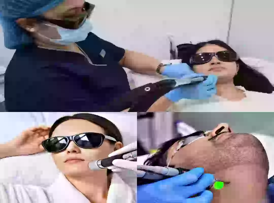 image of nurse giving laser treatment with machine