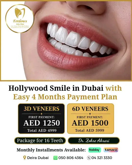 ابتسامة هوليود من ١٢٥٠